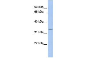 WB Suggested Anti-ODF4 Antibody Titration: 0. (ODF4 抗体  (N-Term))