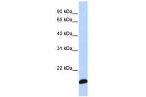Image no. 1 for anti-Peroxiredoxin 5 (PRDX5) (C-Term) antibody (ABIN6741267) (Peroxiredoxin 5 抗体  (C-Term))