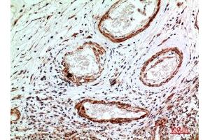 Immunohistochemistry (IHC) analysis of paraffin-embedded Human Brain, antibody was diluted at 1:100. (IL1R1 抗体  (N-Term))