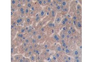 IHC-P analysis of Kidney tissue, with DAB staining. (Complement Factor I 抗体  (AA 358-603))