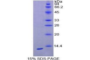SDS-PAGE (SDS) image for Chemokine (C-X-C Motif) Ligand 10 (CXCL10) (AA 22-98) protein (His tag) (ABIN2125395)