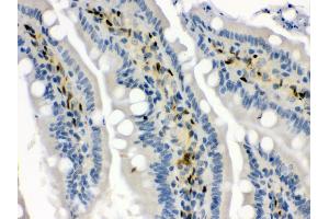 Anti- Hsp70 Picoband antibody, IHC(P) IHC(P): Rat Intestine Tissue (HSP70 1A 抗体  (C-Term))