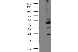 Western Blotting (WB) image for anti-Mannose Phosphate Isomerase (MPI) antibody (ABIN1499546)