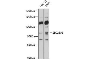 Western blot analysis of extracts of various cell lines, using SLC28 antibody (ABIN6133437, ABIN6147944, ABIN6147945 and ABIN6214531) at 1:1000 dilution. (SLC28A3 抗体  (AA 612-691))
