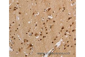Immunohistochemistry of Human brain  using KCNG4 Polyclonal Antibody at dilution of 1:40 (KCNG4 抗体)