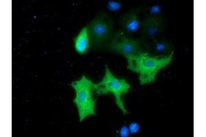 Anti-MTMR14 mouse monoclonal antibody (ABIN2453334) immunofluorescent staining of COS7 cells transiently transfected by pCMV6-ENTRY MTMR14 (RC207732). (MTMR14 抗体)