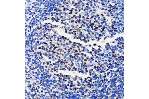 Immunohistochemistry of paraffin-embedded mouse spleen using BRG1/SM antibody (ABIN7270655) at dilution of 1:100 (40x lens). (SMARCA4 抗体)