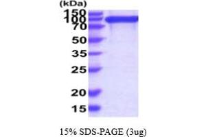 SDS-PAGE (SDS) image for Integrin beta 1 (ITGB1) (AA 1-728) protein (His tag) (ABIN7281219) (ITGB1 Protein (AA 1-728) (His tag))