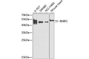 Western blot analysis of extracts of various cell lines, using BNIP2 antibody (ABIN6131406, ABIN6137618, ABIN6137619 and ABIN6221879) at 1:1000 dilution. (BNIP2 抗体  (AA 125-280))