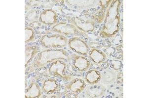 Immunohistochemistry (IHC) image for anti-Mitochondrially Encoded NADH Dehydrogenase 5 (MT-ND5) (AA 500-600) antibody (ABIN6144435)