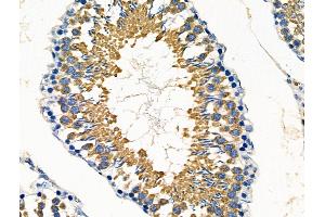 ABIN6260022 and ABIN6276440 at 1/100 staining Rat testis tissue by IHC-P. (ARF6 抗体  (Internal Region))