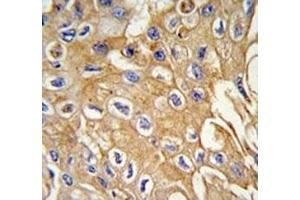 Immunohistochemistry (IHC) image for anti-Receptor-Interacting serine-threonine Kinase 3 (RIPK3) (AA 61-91) antibody (ABIN3032449)