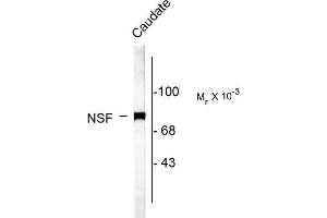 Image no. 1 for anti-N-Ethylmaleimide-Sensitive Factor (NSF) (C-Term) antibody (ABIN372691) (NSF 抗体  (C-Term))