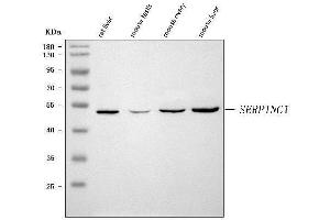 Western blot analysis of Antithrombin III/SERPINC1 using anti-Antithrombin III/SERPINC1 antibody (ABIN7602610).