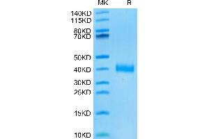 SDS-PAGE (SDS) image for SARS-CoV-2 Spike (BA.4 - Omicron), (BA.5 - Omicron), (RBD) protein (His tag) (ABIN7273903)