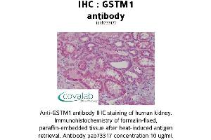 Image no. 1 for anti-Glutathione S-Transferase mu 1 (GSTM1) (AA 1-159) antibody (ABIN1735304) (GSTM1 抗体  (AA 1-159))