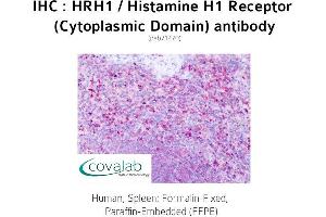 Image no. 1 for anti-Histamine Receptor H1 (HRH1) (3rd Cytoplasmic Domain) antibody (ABIN1735570) (HRH1 抗体  (3rd Cytoplasmic Domain))