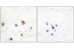 Immunohistochemistry analysis of paraffin-embedded human brain tissue, using JIP2 Antibody. (IB2 抗体  (AA 581-630))