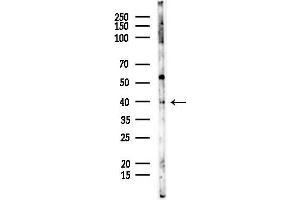 anti-Ceroid-Lipofuscinosis, Neuronal 6, Late Infantile, Variant (CLN6) (Internal Region) antibody