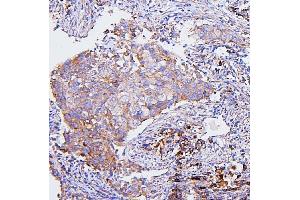IHC analysis of CETP using anti-CETP antibody (ABIN7602439). (CETP 抗体  (AA 77-353))