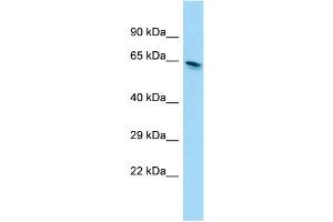 WB Suggested Anti-EEFSEC Antibody Titration: 1. (EEFSEC 抗体  (C-Term))