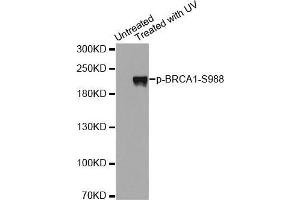 Western blot analysis of extracts from Hela cells using Phospho-BRCA1-S988 antibody. (BRCA1 抗体  (pSer988))