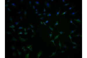 Immunofluorescence staining of U251 cells with ABIN7171646 at 1:100, counter-stained with DAPI. (TBC1D3G 抗体  (AA 312-549))