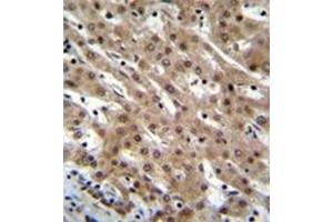 Formalin fixed and paraffin embedded human liver tissue reacted with Pinin / PNN  Antibody  followed by peroxidase conjugation of the secondary antibody and DAB staining. (PNN 抗体  (Middle Region))