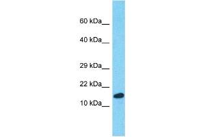Western Blotting (WB) image for anti-Peptidylprolyl Isomerase A (Cyclophilin A) (PPIA) (Middle Region) antibody (ABIN2791868) (PPIA 抗体  (Middle Region))