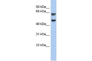 WB Suggested Anti-ZP1 Antibody Titration: 0. (ZP1 抗体  (Middle Region))