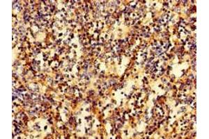 Immunohistochemistry of paraffin-embedded human spleen tissue using ABIN7167270 at dilution of 1:100 (RAB27A 抗体  (AA 2-221))