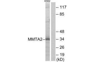 Western blot analysis of extracts from K562 cells, using MMTA2 antibody. (C1orf35 抗体  (N-Term))