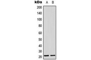 Western blot analysis of Adrenomedullin expression in MCF7 (A), mouse lung (B) whole cell lysates. (Adrenomedullin 抗体  (Center))