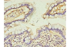Immunohistochemistry of paraffin-embedded human small intestine tissue using ABIN7146497 at dilution of 1:100 (CALML4 抗体  (AA 1-120))
