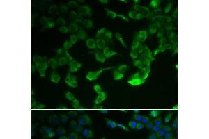 Immunofluorescence analysis of HeLa cells using C1R Polyclonal Antibody (C1R 抗体)