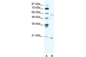 Western Blotting (WB) image for anti-Zinc Finger Protein 18 (ZNF18) antibody (ABIN2460737) (ZNF18 抗体)