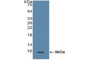Detection of Recombinant BRCA1, Human using Polyclonal Antibody to Breast Cancer Susceptibility Protein 1 (BRCA1) (BRCA1 抗体  (AA 19-83))