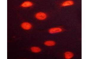 ABIN6267691 staining HeLa cells by ICC/IF. (RACGAP1 抗体  (pSer387))