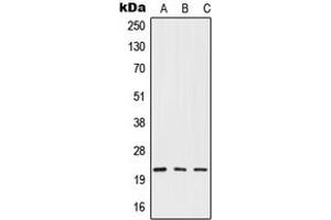 Western blot analysis of IFN beta expression in HepG2 (A), mouse liver (B), rat liver (C) whole cell lysates. (IFNB1 抗体  (Center))