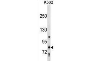 Western Blotting (WB) image for anti-Glycosyltransferase 25 Domain Containing 2 (GLT25D2) antibody (ABIN2999969) (GLT25D2 抗体)