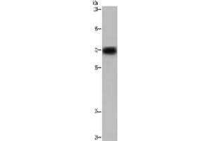 Gel: 6 % SDS-PAGE, Lysate: 40 μg, Lane: Mouse heart tissue, Primary antibody: ABIN7129956(KCND3 Antibody) at dilution 1/700, Secondary antibody: Goat anti rabbit IgG at 1/8000 dilution, Exposure time: 30 seconds (KCND3 抗体)