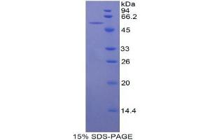 SDS-PAGE analysis of Mouse bACE1 Protein. (BACE1 蛋白)