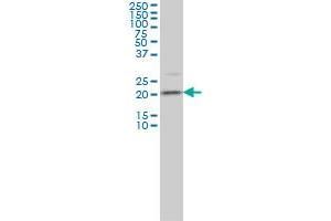 TAGLN3 monoclonal antibody (M01), clone 1D2 Western Blot analysis of TAGLN3 expression in IMR-32 . (Transgelin 3 抗体  (AA 1-199))