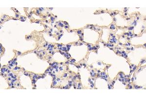 Immunohistochemistry (IHC) image for anti-Albumin (ALB) antibody (ABIN7429670)
