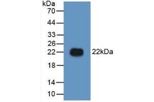 Detection of Recombinant HMG1, Human using Polyclonal Antibody to High Mobility Group Protein 1 (HMGB1) (HMGB1 抗体  (AA 9-163))