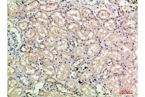 Immunohistochemical analysis of paraffin-embedded human-kidney, antibody was diluted at 1:200 (Selectin E/CD62e 抗体)