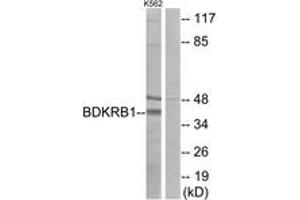 Western blot analysis of extracts from K562 cells, using BDKRB1 Antibody. (BDKRB1 抗体  (AA 201-250))