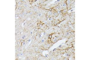 Immunohistochemistry of paraffin-embedded rat brain using TBCA antibody (ABIN6131384, ABIN6148884, ABIN6148885 and ABIN6216894) at dilution of 1:100 (40x lens). (TBCA 抗体  (AA 1-108))
