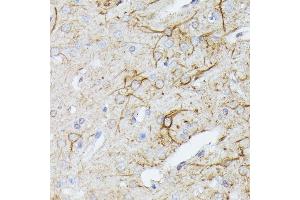 Immunohistochemistry of paraffin-embedded rat brain using TBCA antibody (ABIN6131384, ABIN6148884, ABIN6148885 and ABIN6216894) at dilution of 1:100 (40x lens).