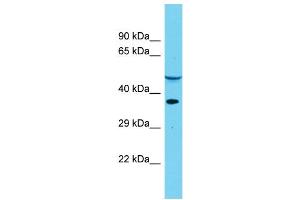 Host: Rabbit Target Name: DUS4L Sample Type: Placenta lysates Antibody Dilution: 1. (DUS4L 抗体  (Middle Region))